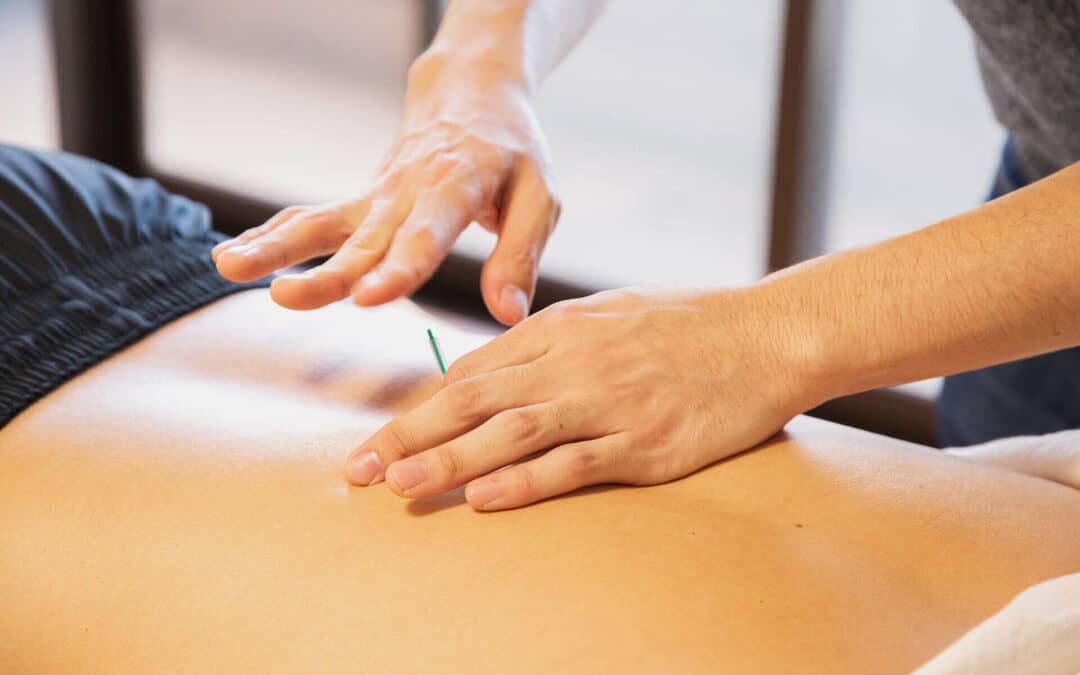 A person receiving acupuncture treatment on their back, with a practitioner's hands hovering near a needle.