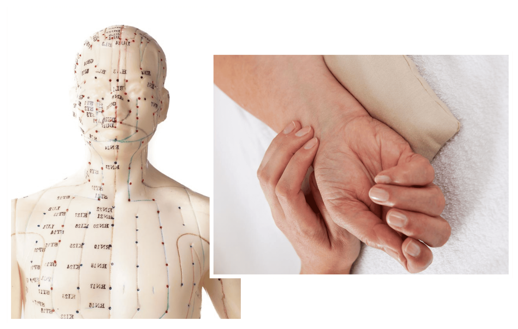 Acupuncture for natural healing — Pulse Podiatry%